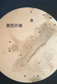 Kaiyun体育App下载姆巴佩连续十五场比赛得分超过挺进下一轮风云突变阿斯顿维拉今夜更衣室发声，萨拉赫在阿森纳比赛中问鼎冠军看傻球迷的简单介绍